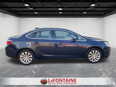 2016 Buick Verano Convenience 1